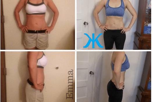 t25 before and after women