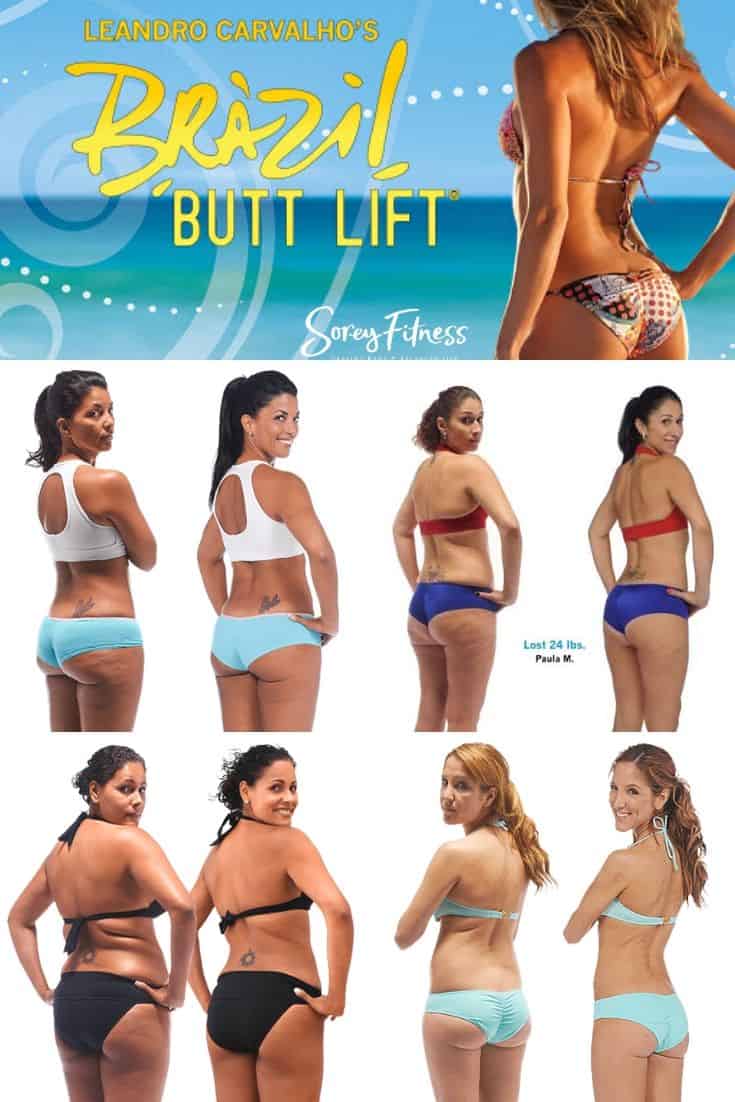 Collage of Brazil Butt Lift Results - 4 Before and After photos
