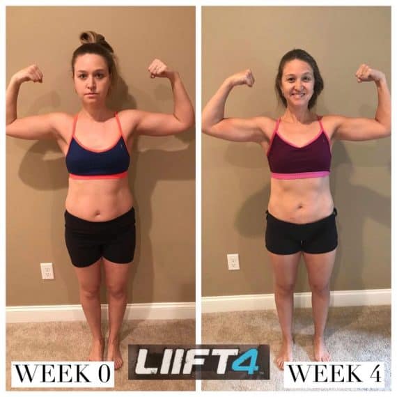 LIFT4 before and after photo