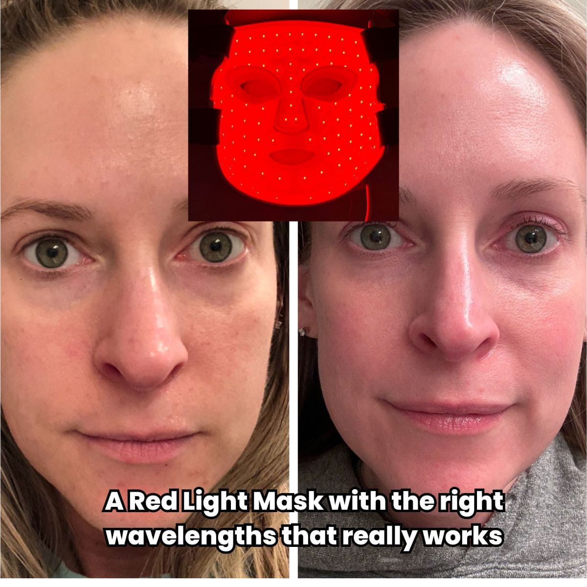 red light mask before and after