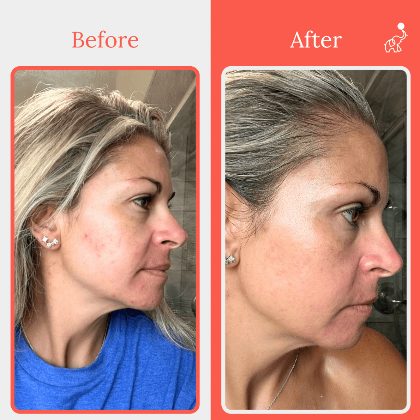 Amber before and after using EllieVate Skin+ Topical Rejuvenating Serum