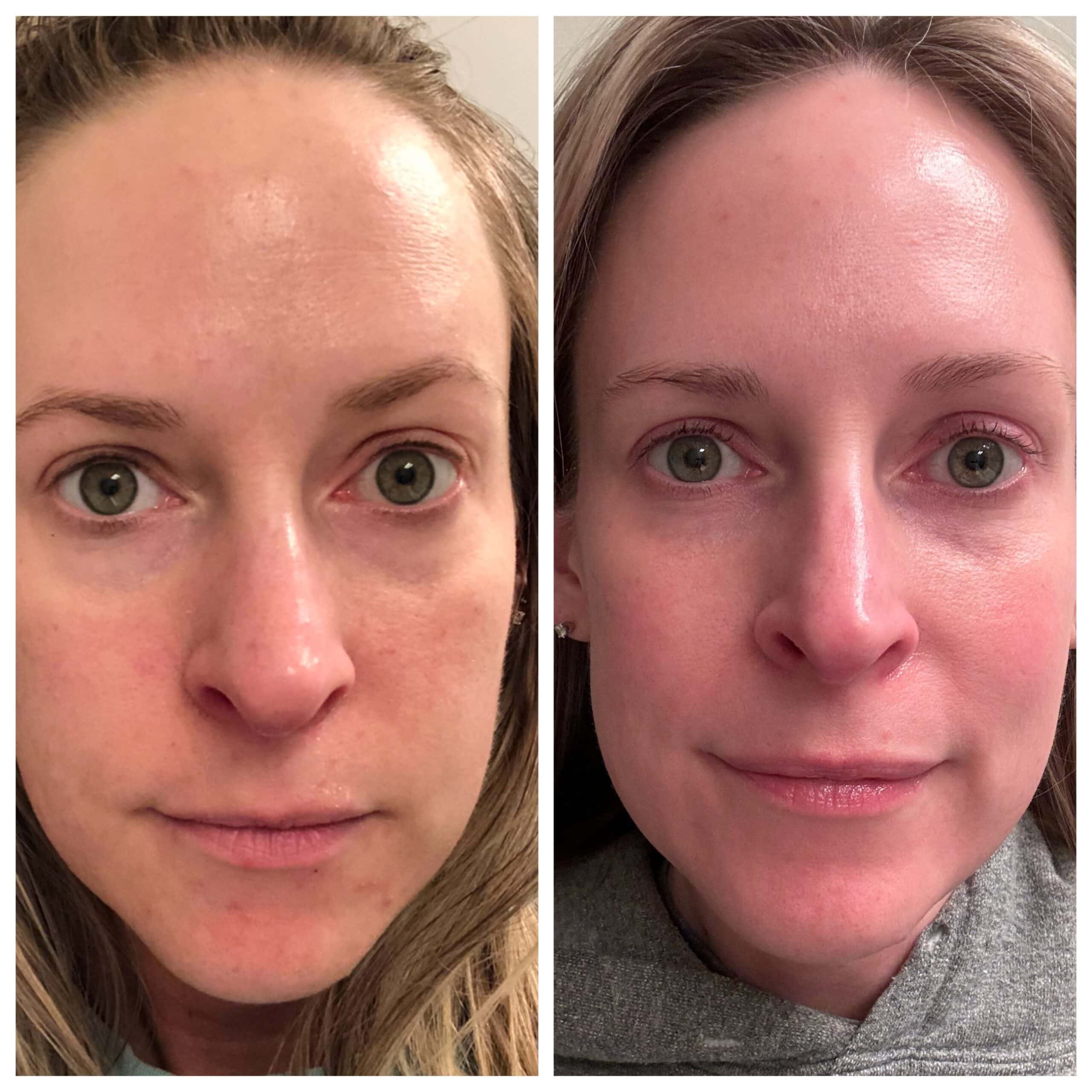 currentbody series 2 mask review and before and after
