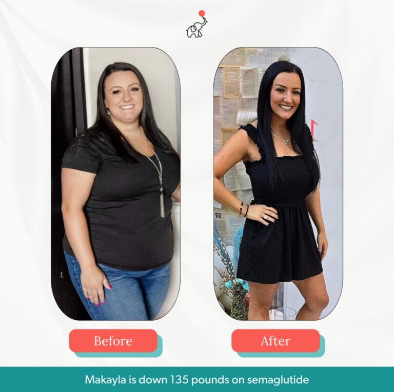 makayla-weight-loss-elliemd before and after