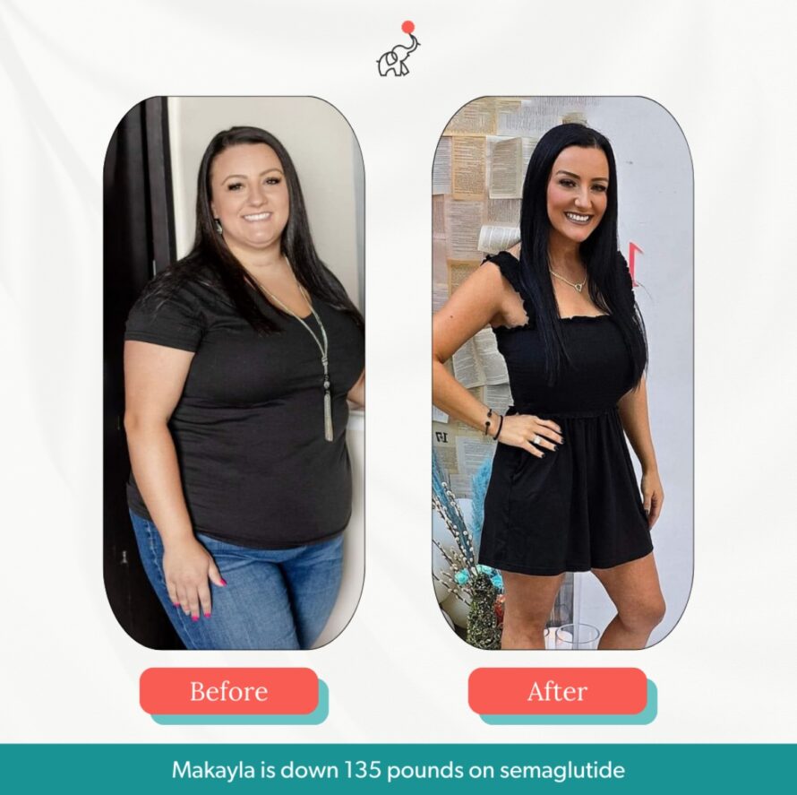 makayla-weight-loss-elliemd before and after