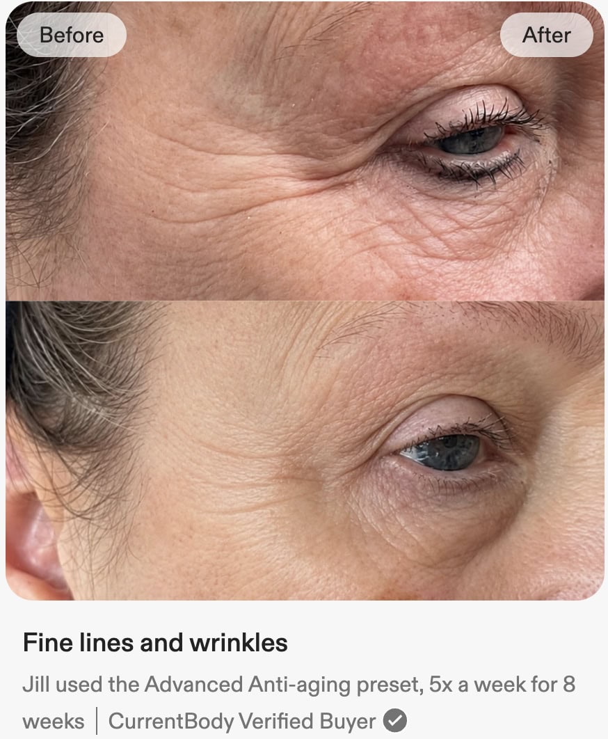 before-and-after-currentbody-series-3-mask-results